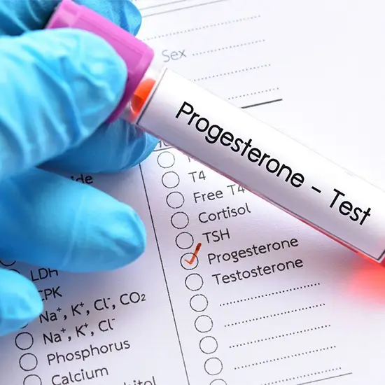 Serum Progesterone Test